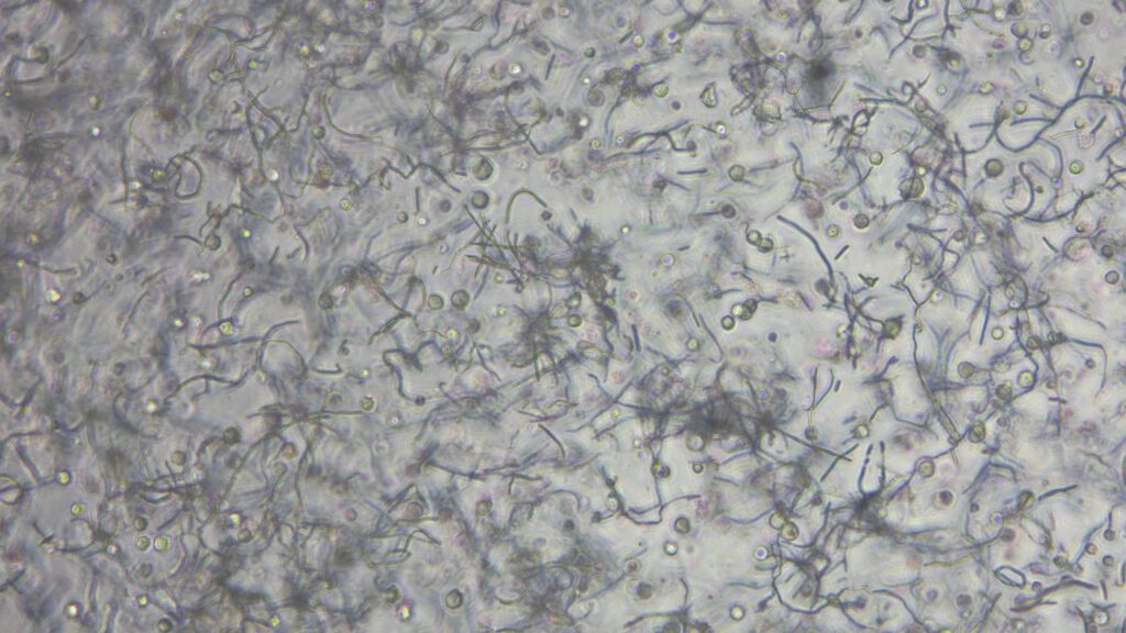 NMI, Nahaufnahme der Biotinte. Die linienförmigen Elemente sind die elektro-gesponnenen Fasern, die runden Punkte sind Zellen.