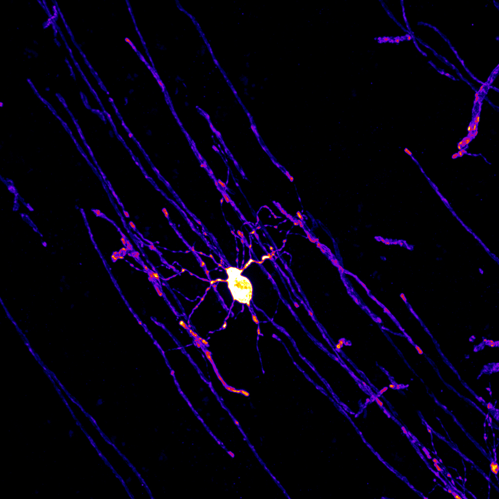 Wachstumsfaktor Erythropoietin verbessert Denkprozesse im Gehirn – Potenzial für Therapien